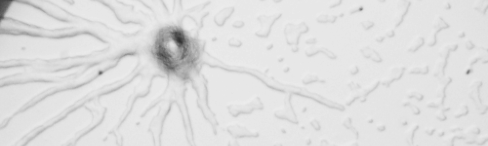 細胞性粘菌の集合の写真